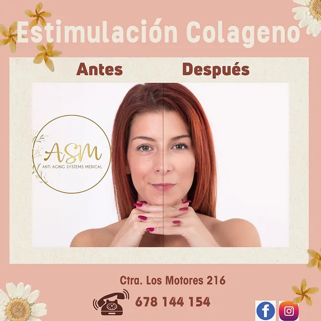 ASM Centro de medicina Estética instagram